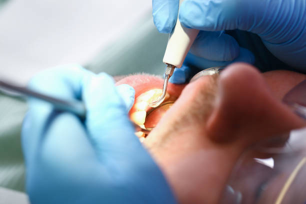Best Broken or Chipped Tooth Repair in Middleborough Center, MA